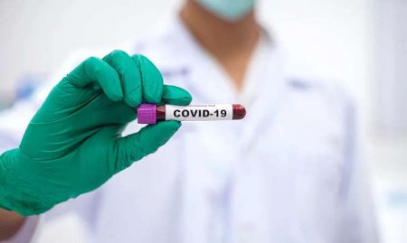 SON DƏQİQƏ: Azərbaycanda son sutkada koronavirusa yoluxanların sayı artdı - RƏSMİ