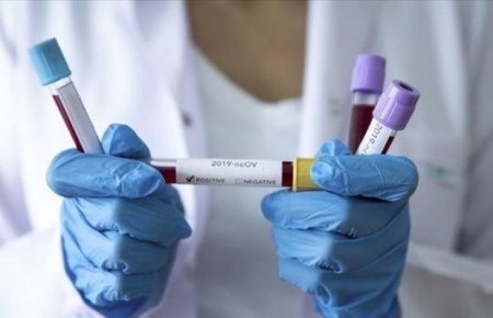 Azərbaycanda daha 6 nəfər koronavirusdan öldü – 352 YENİ YOLUXMA VAR