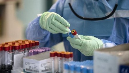 Azərbaycanda koronavirus ilə bağlı son vəziyyət açıqlandı - ÖLƏNLƏR ARTIR