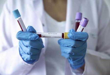 Azərbaycanda daha bir yüksək vəzifəli məmur koronavirusa yoluxdu