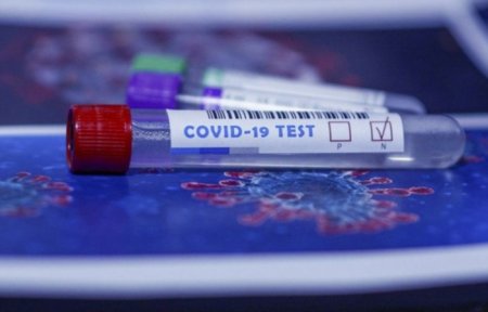 226 nəfər koronavirusa yoluxdu, 588 sağalma - 5 ölü